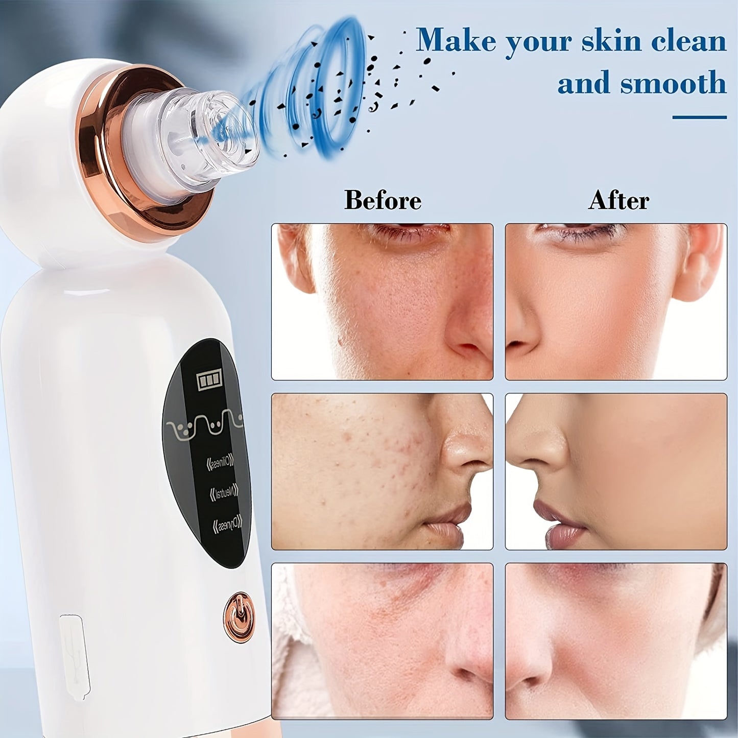 USB Rechargeable Facial Pore Cleaner with Water Cycle and Vacuum Suction - Blackhead Remover for Women and Men - Acne and Pimple Removal Tool