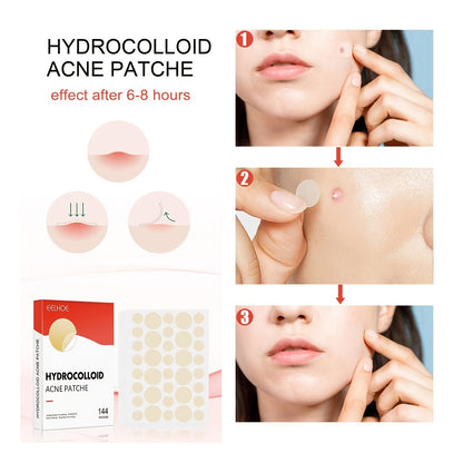 144pcs Acne Pimple Patch - Invisible Professional Absorbing Spot Sticker for Men and Women - Skin Care Solution in 2 Sizes