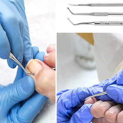 3pcs Professional Stainless Steel Ingrown Toenail Tool Kit - Includes File and Lifters for Pain-Free Nail Treatment and Pedicure