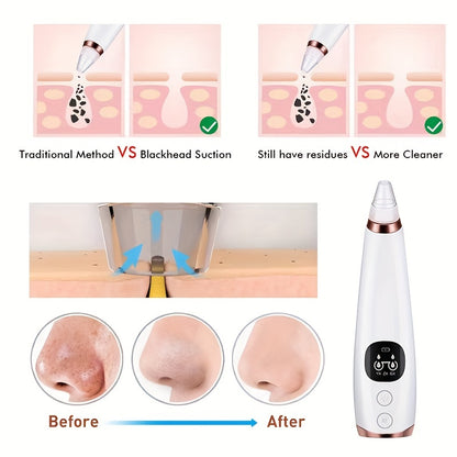 Blackhead, Grease, And Acne Removal Tools - Use This Intelligent Upgraded Facial Cleaning And Beauty Instrument To Immediately Give You A Clean, Clear, And Beautiful Face