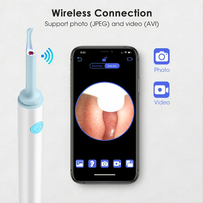 Wireless Ear Cleaning Kit with 6 LED Lights and Camera - Effectively Removes Ear Wax and Debris for Clearer Hearing and Vision